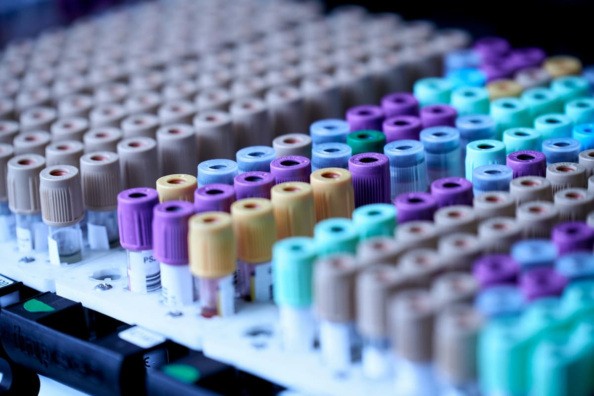 Sample vials arranged in a laboratory rack