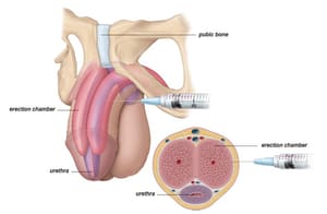 Andrological diagnostics illustration